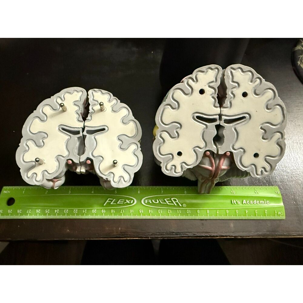 Life Size Human Brain Model - Medical Teaching (w/ 4 sections) EUC - Picture 8 of 10